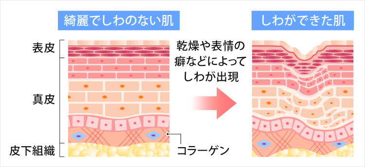 乾燥や表情の癖などが原因でおでこのしわが生じる仕組み