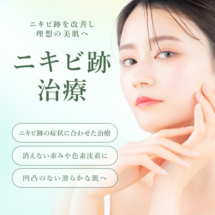 ニキビ跡治療