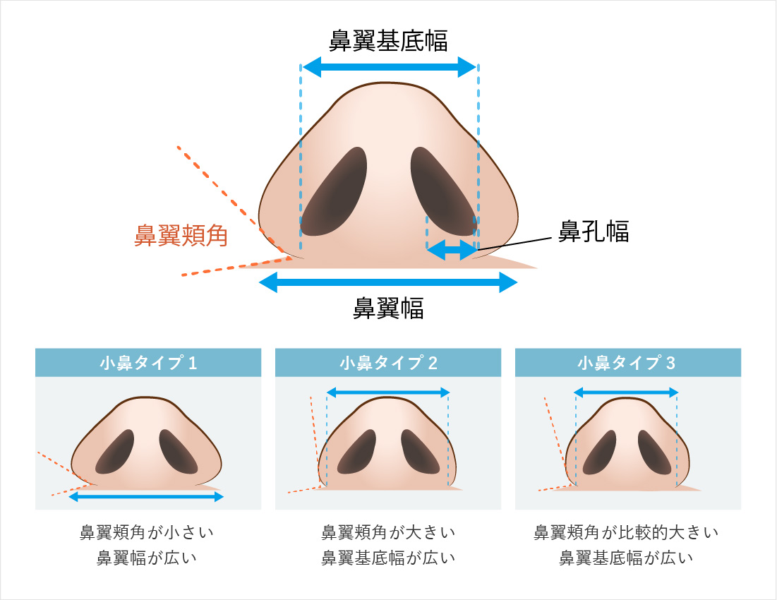 小鼻の幅やバランスについて