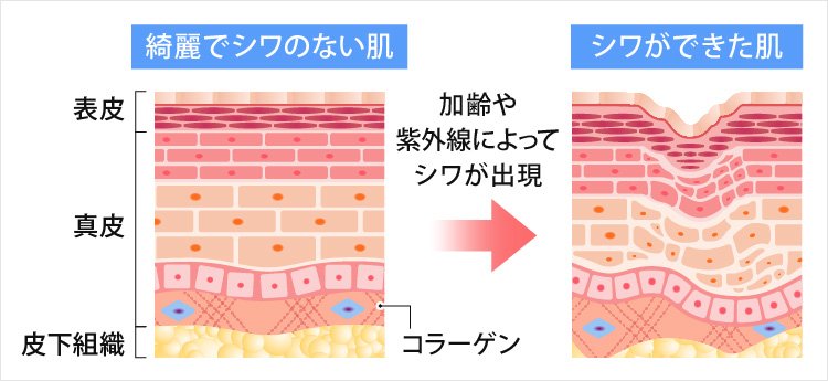 シワの原因