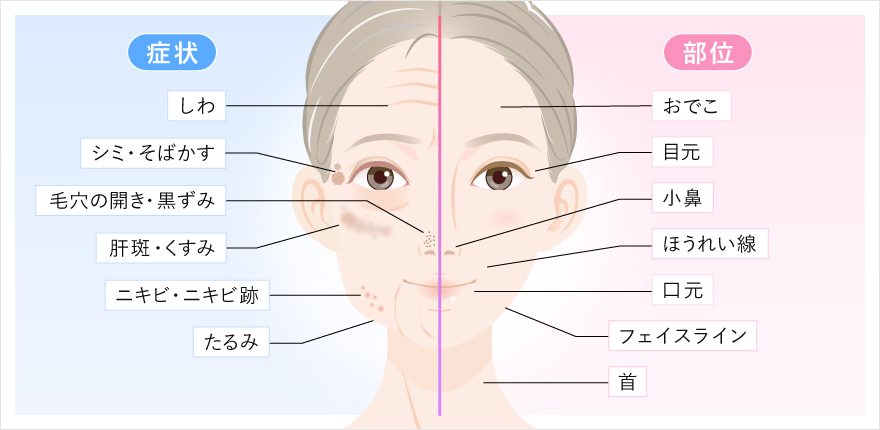 肌の症状と顔周りの部位を示したイメージ