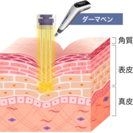 ヴェルベットスキンの仕組み