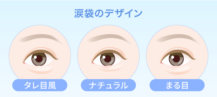 涙袋形成（ヒアルロン酸注射）のデザイン