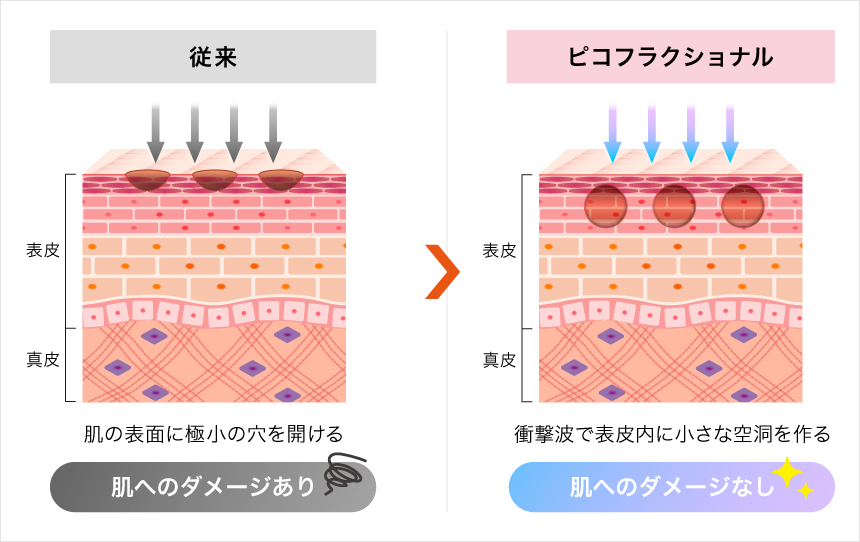 ピコフラクショナルとは