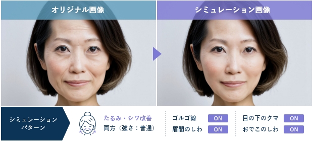 理想の若返りをシミュレーション