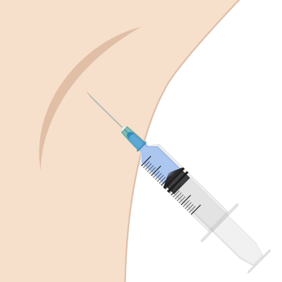脇にボトックス注射を打つイラスト