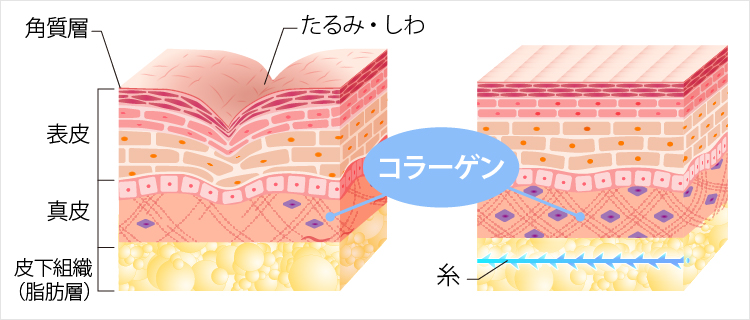肌質改善のイメージ