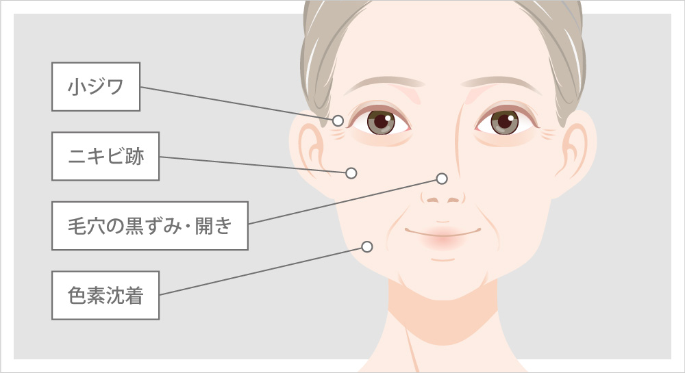 ケミカルピーリングの効果