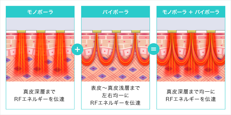 ダイヤモンドチップ