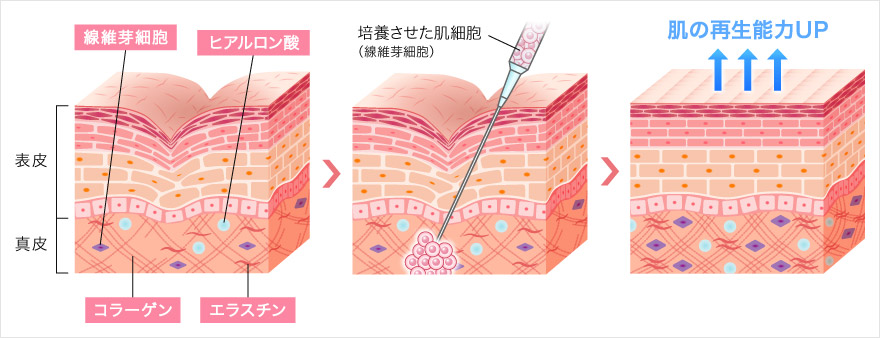 肌老化の原因と仕組み