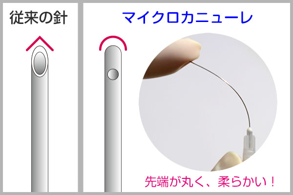 マイクロカニューレの特徴