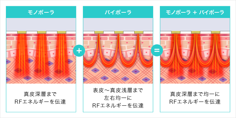 ダイヤモンドチップの仕組み