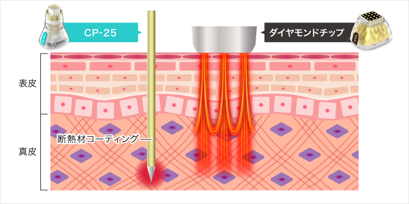 ダウンタイムが短い