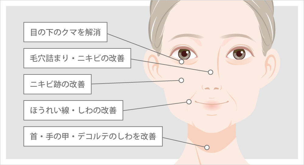 リジュラン（サーモン注射）の効果