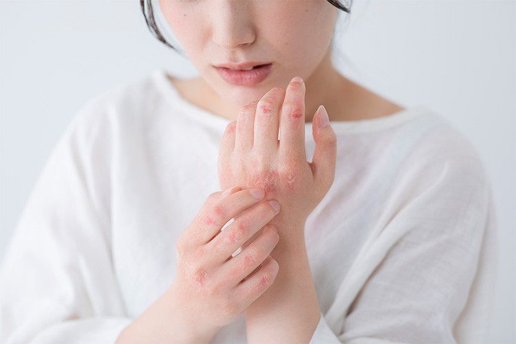 ダーマペンはアトピー性皮膚炎でも受けられる?効果や注意点を紹介