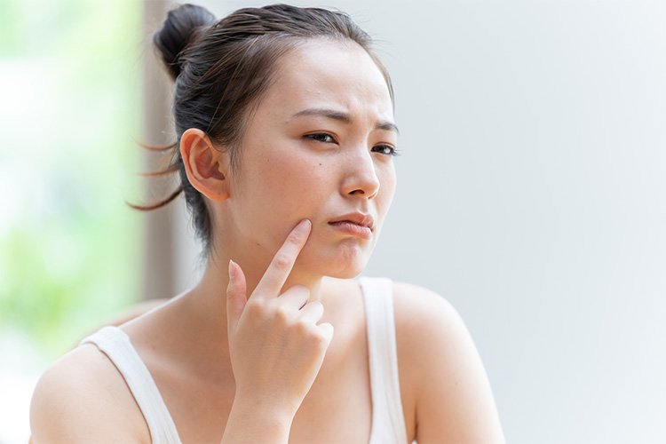 ダーマペン後の白ニキビの原因は?できやすい人の特徴や対処法を紹介