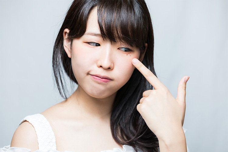 目元のほくろはどんな印象?消したい・欲しい方におすすめな方法をそれぞれ解説