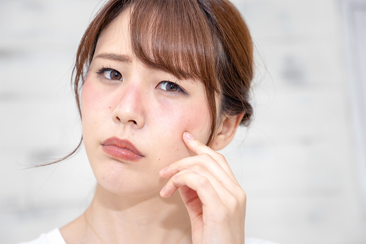 日焼けをするとほくろが増える?原因や治療法について解説