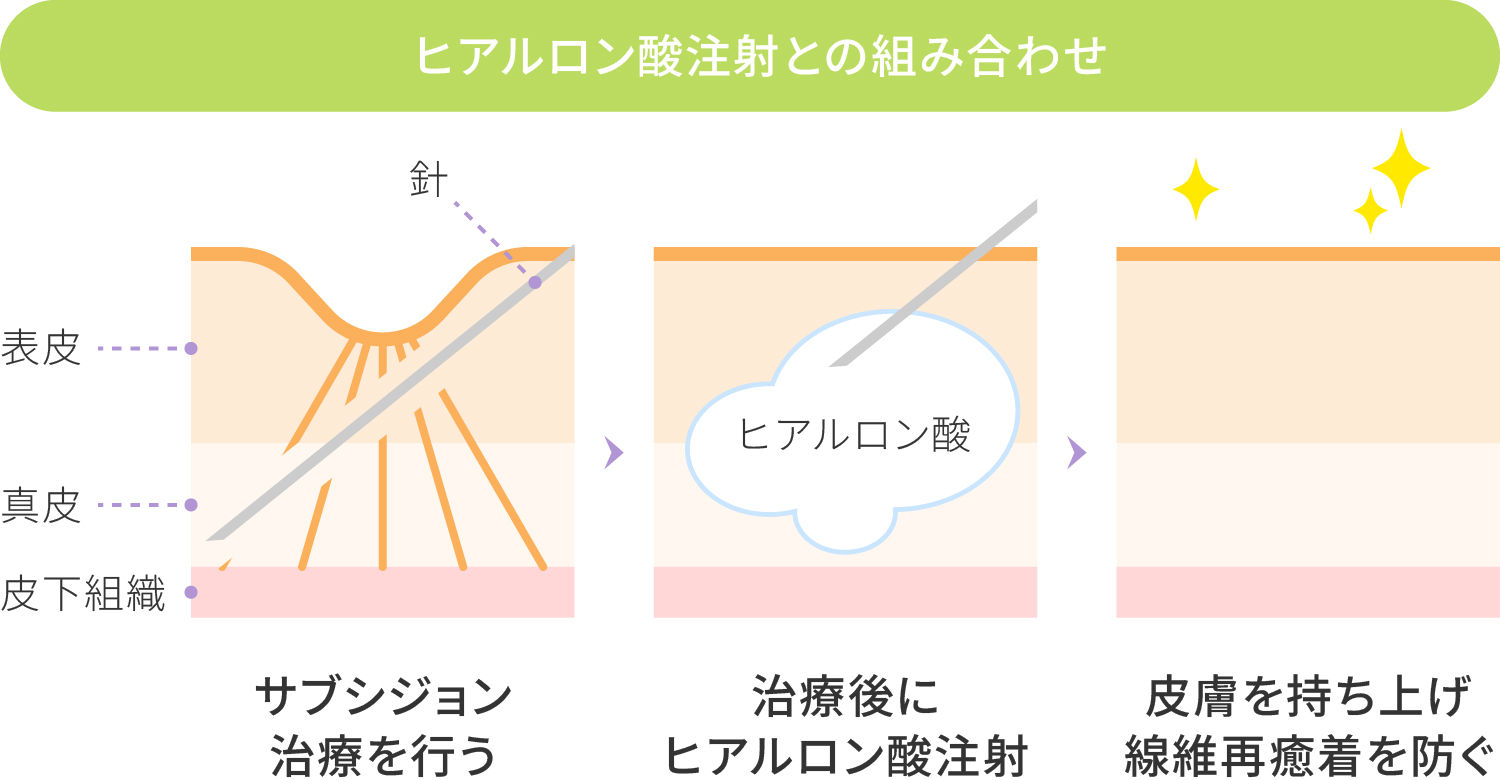 おすすめの組み合わせ治療